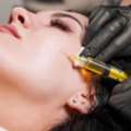 Emphasize Microneedling With Toskani For Healthier-Looking Skin