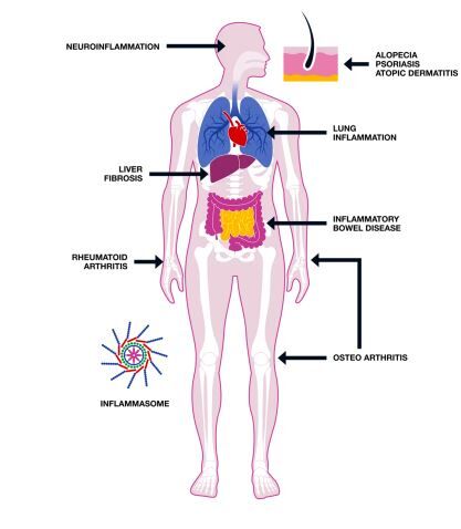London, Business, Inflammation Assays