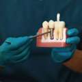 Trusted Professional Teeth Whitening At Rosedale Smiles