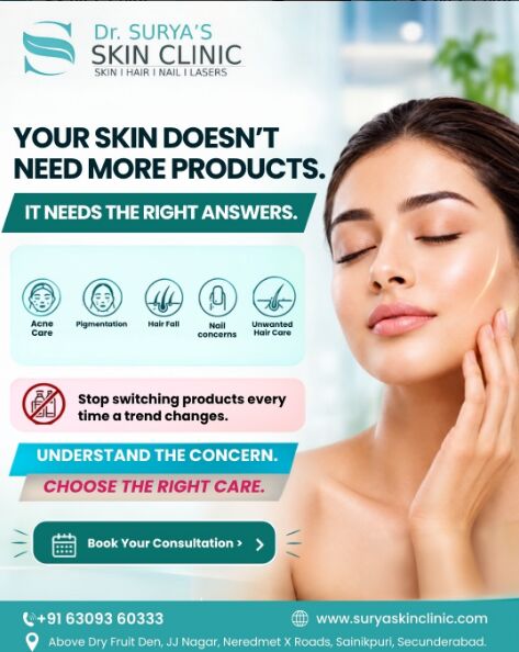 Mumbai, Health, Effective Pigmentation Treatment In Secunderabad For Clearer, Healthier-Looking Skin