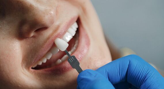 Sydney, Dental, Find Personalised Dental Implant Solutions In Greensborough