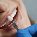 Find Personalised Dental Implant Solutions In Greensborough