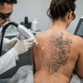 When Your Tattoo No Longer Feels Like You