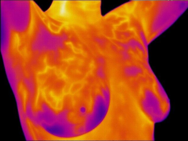 New York, Health, Discover Body Thermogram San Marcos Thermal Imaging Services
