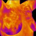Discover Body Thermogram San Marcos Thermal Imaging Services