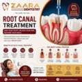 Best Root Canal Treatment In Madurai