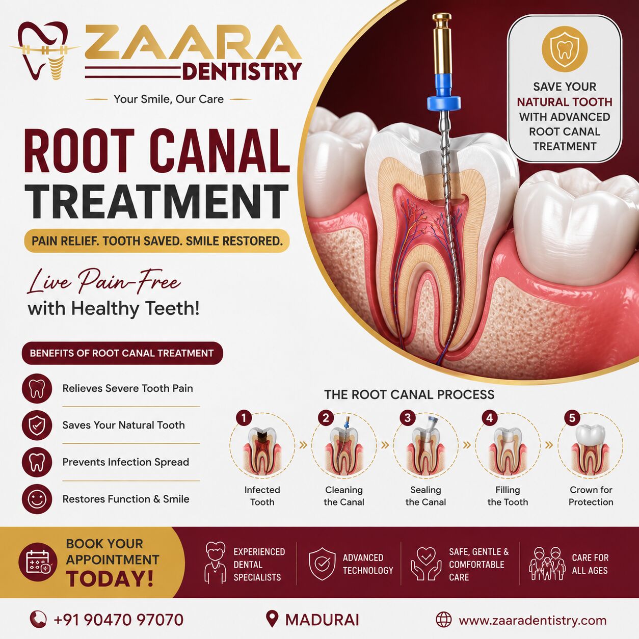 Madurai, Creative, Best Root Canal Treatment In Madurai