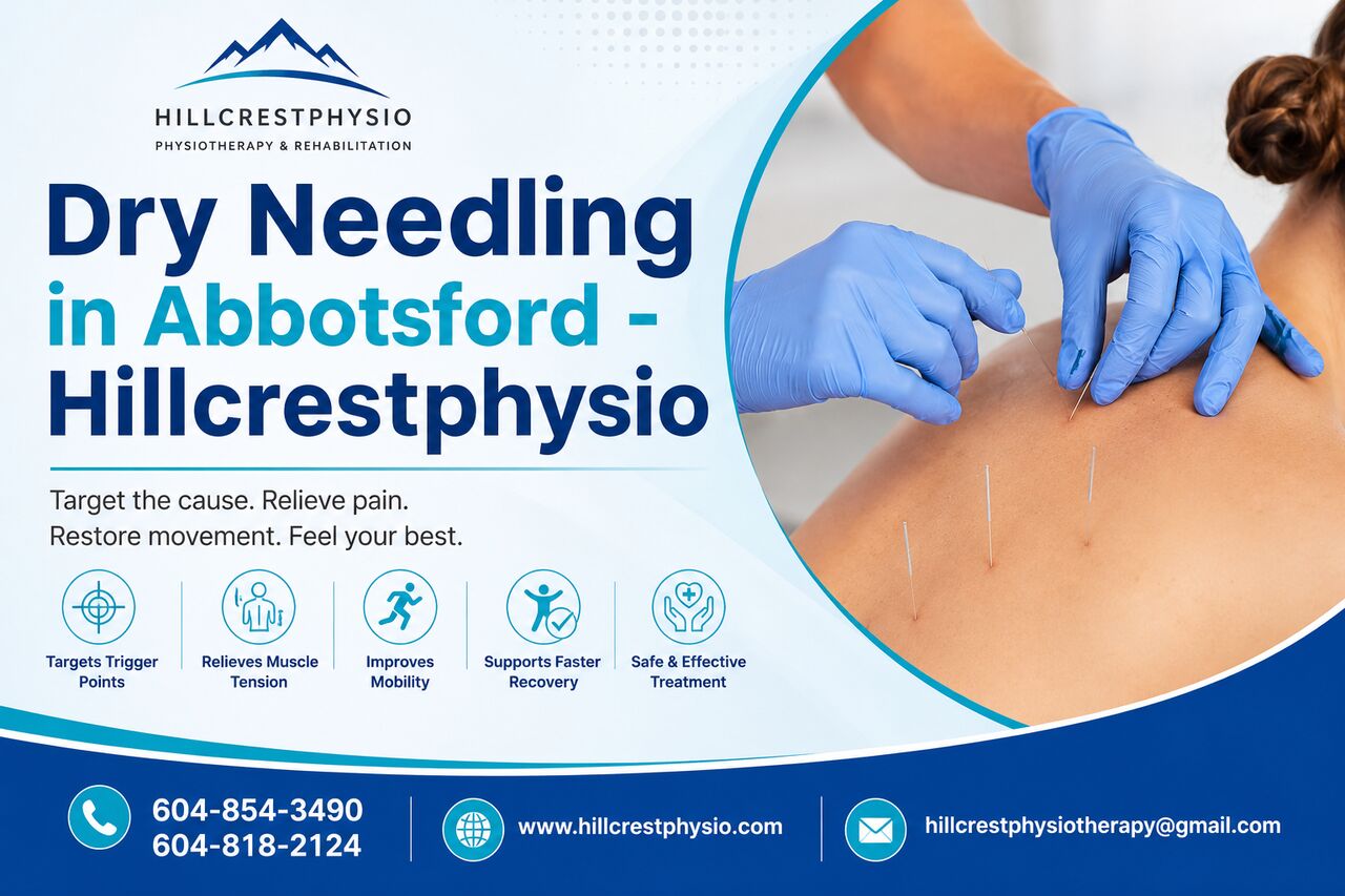 Toronto, Health, Dry Needling In Abbotsford - Hillcrestphysio