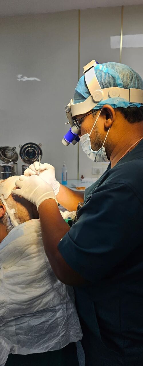 New Delhi, Health, Best Hair Transplant Doctor In Delhi | Advanced Hair Restoration Clinic | Alloroots