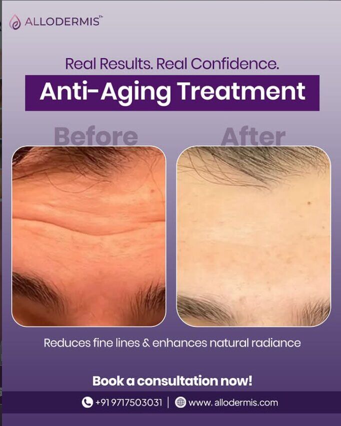Bhubaneswar, Health, Allodermis Skin Clinic | Advanced Dermatology & Botox Treatment In Bhubaneswar