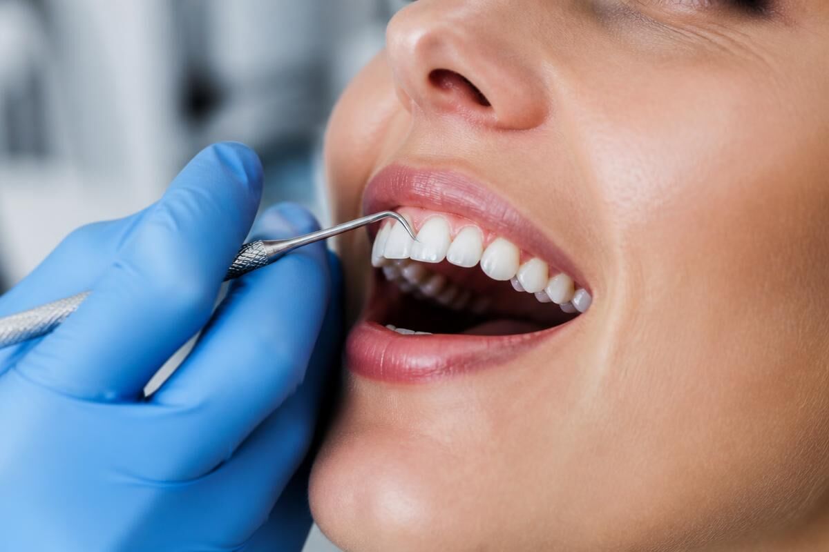 London, Dental, Broken Tooth Dentist In Leigh On Sea