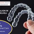 Invisalign In Tirunelveli