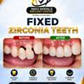 Get Fixed Zirconia Teeth In AS Rao Nagar & ECIL | Permanent Smile Makeover