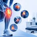 Best Orthopedic Doctor In Begumpet