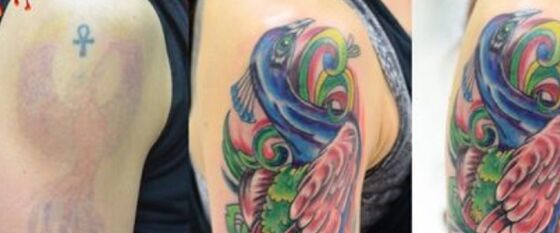 Sydney, Beautician, Book A Tattoo Cover Up Artist In Adelaide Today