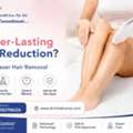 Want Longer-Lasting Hair Reduction? Explore Laser Hair Removal