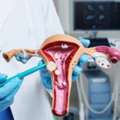 Best Piles Surgeon In Delhi | Expert Piles Treatment