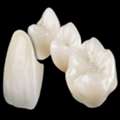 Zirkonium Krone From China: Quality Dental Restorations At Competitive Prices