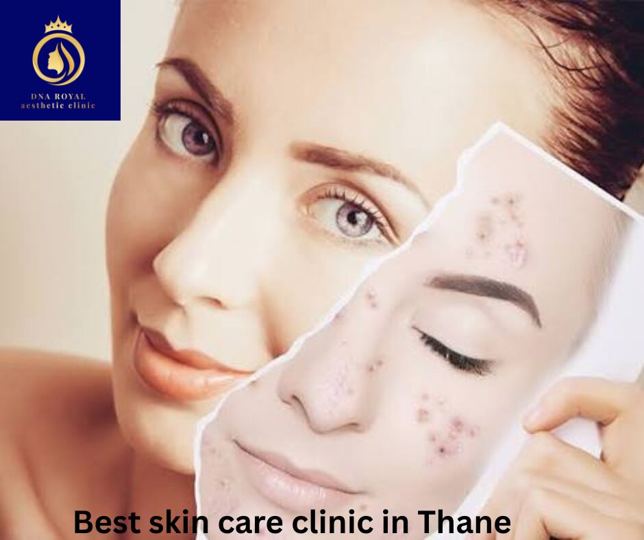 Thane, Fashion & Design, DNA Royal &ndash; Best Skin Care Clinic In Thane For Advanced Skin Treatments.