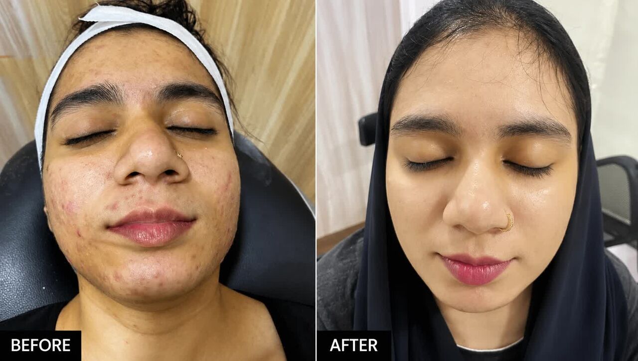 Mumbai, Daycare, Skin Specialist In Mira Road