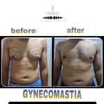 Mumbai, Daycare, Breast Augmentation In Mumbai