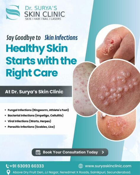 Mumbai, Health, Say Goodbye To Skin Concerns With The Best Skin Clinic In Secunderabad