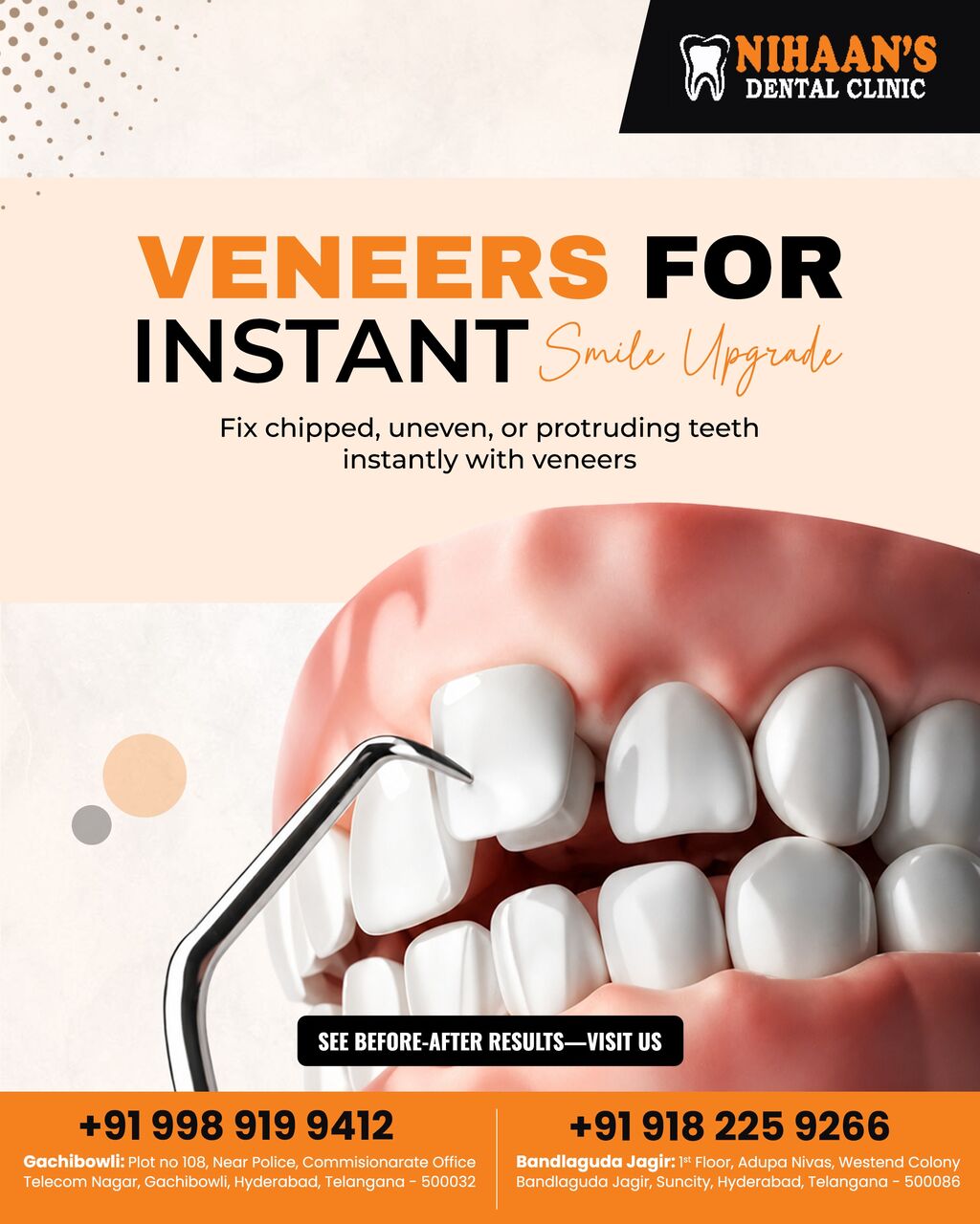 Hyderabad, Dental, Nihaans Dental Clinic - Dental Clinic In Bandlaguda Jagir