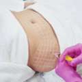 Non Surgical Body Fat Dissolving Treatment | Targeted Fat Reduction
