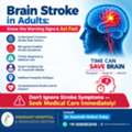 Brain Stroke In Adults: Risk Factors, Symptoms And Treatment