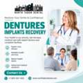 How Long Does Denture Implants Recovery Take?