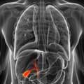 Posting Title: Best Robotic Gallbladder Surgery In Delhi | Advanced Treatment
