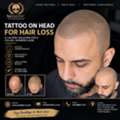 Hair Tattoo For Hair Loss &ndash; Natural-Looking Scalp Micropigmentation