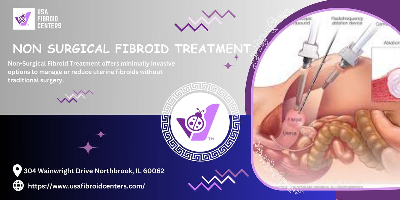 New York, Health, Non Surgical Fibroid Treatment