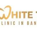 Smile Designing In Mumbai-white Tusk