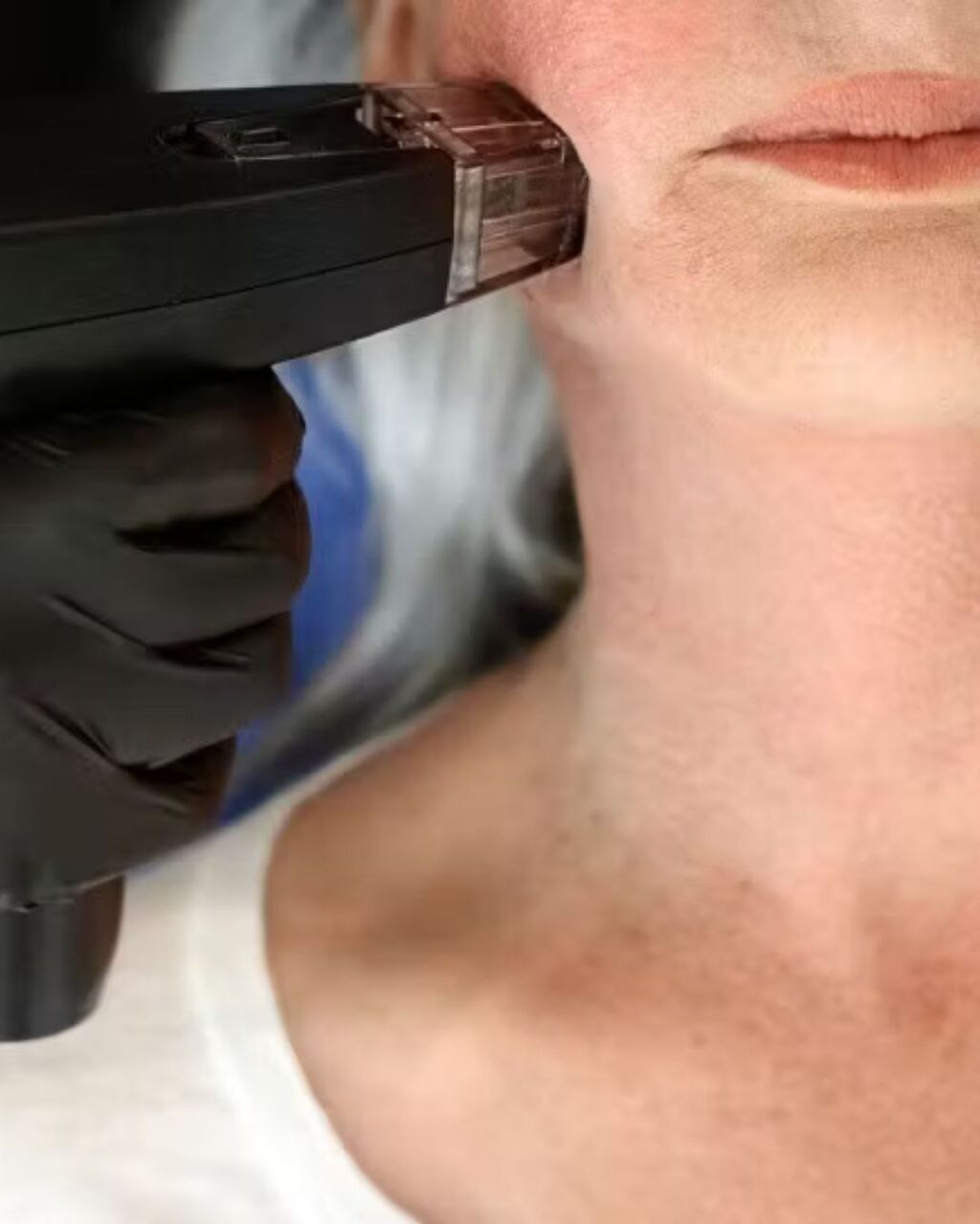 New York, Business, Laser Vein Treatment Mississauga