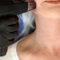 Laser Vein Treatment Mississauga