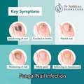 Fungal Nail Symptoms And Treatment At Dermacure - Rajahmundry