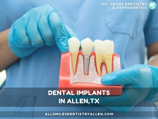 Dallas, Dental, Get Dental Implants In Allen, TX Restore Your Smile Confidence