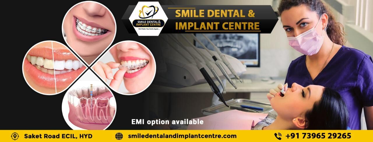 Hyderabad, Dental, Top-Rated Dental Hospital Near Me In AS Rao Nagar, Secunderabad