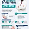 Clubfoot Treatment For Children In Jalandhar