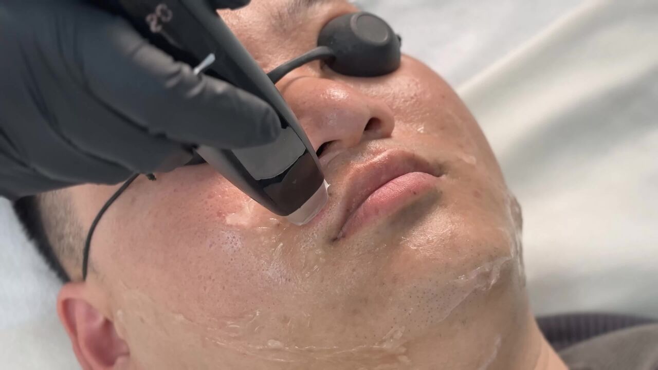 Houston, Health, Laser Hair Removal Houston For Smooth And Long-Lasting Skin