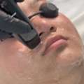 Laser Hair Removal Houston For Smooth And Long-Lasting Skin