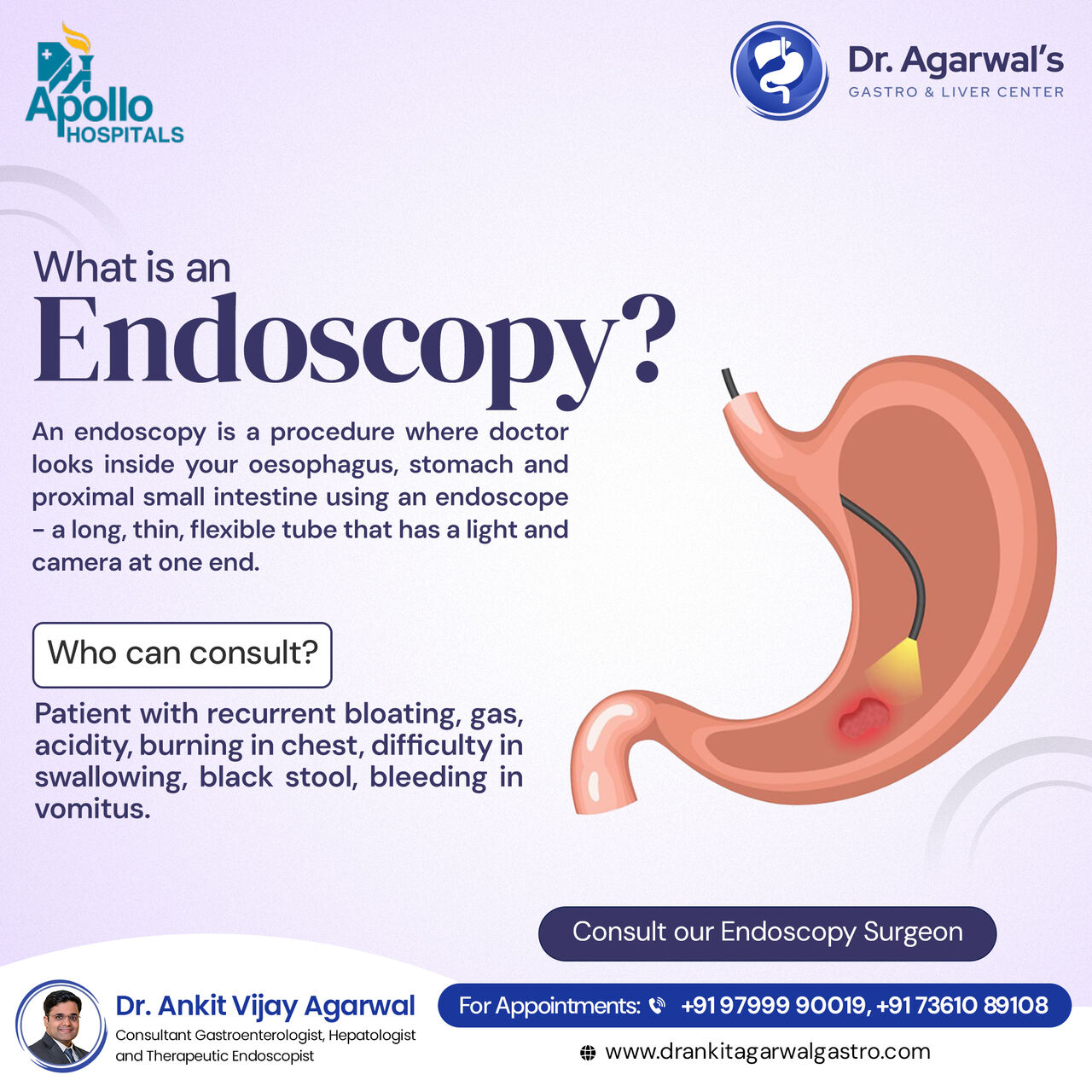 Hyderabad, Health, Gastroesophageal Reflux Disease Treatment In Hyderabad