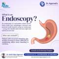 Gastroesophageal Reflux Disease Treatment In Hyderabad