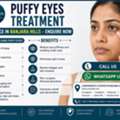 INR 3,  Puffy Eyes Treatment Price In Banjara Hills &mdash; Near Venkat Nagar
