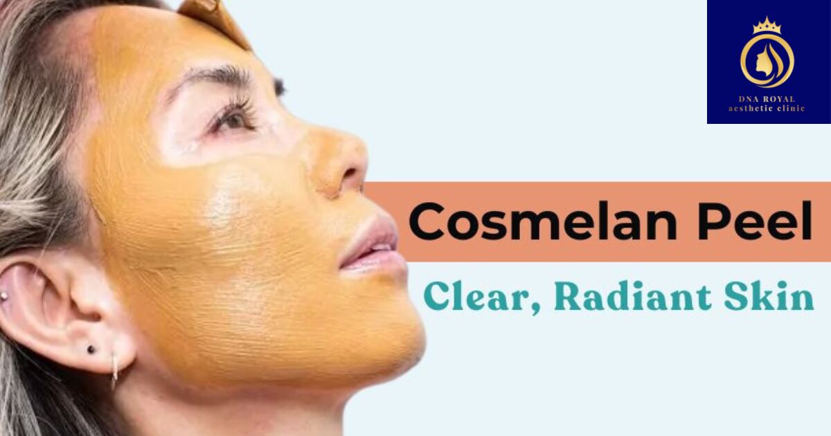 Thane, Fashion & Design, Cosmelan Treatment In Thane For Pigmentation & Melasma | DNA Royal.