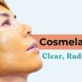 Cosmelan Treatment In Thane For Pigmentation & Melasma | DNA Royal.