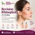 Revision Rhinoplasty In India For Natural And Balanced Nose Results