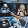 See Your Baby Clearly With 4D Ultrasound & 3D Ultrasound Near Me