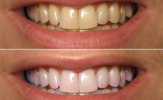 Al Nahda, Dental, Achieve A Brighter, Radiance-Boosting Smile In Dubai &mdash; AFFORD Clinic In Al Nahda &mdash; Dubai